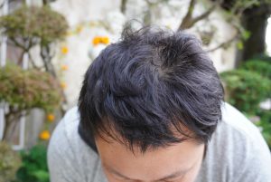 多立寶 東森 多髮寶 生髮 養髮 健髮 育髮 掉髮 CSC 落髮