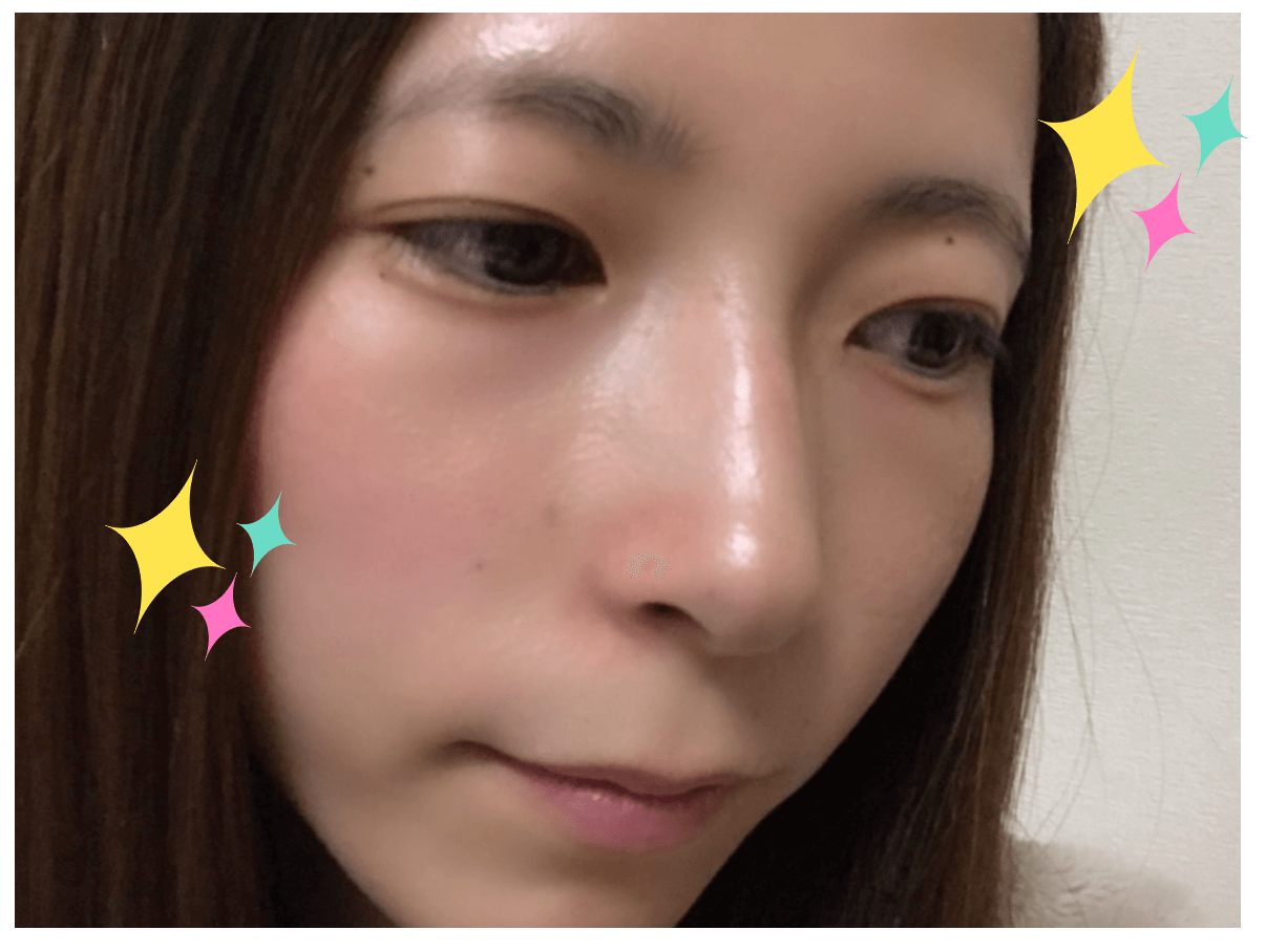 俏樂斯 沖繩 褐藻 碳酸泡泡 碳酸洗臉 碳酸面膜 洗卸 邊洗邊保養 黑頭 白頭 閉鎖性 毛孔 草莓鼻 粉刺 坑洞 凹洞 粗糙 暗沈 粉刺林
