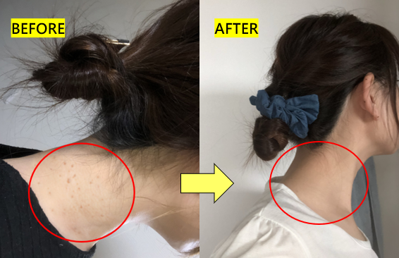 俏樂斯 曾沛慈 小綠餅 美白 抗皺 幼美肌 全方位保濕水凝霜 肉芽 顆粒 脂肪粒 醫美 電燒 除肉芽 淡化斑點 保濕 凝膠 沖繩 薏米 巴鈺