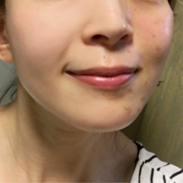 face